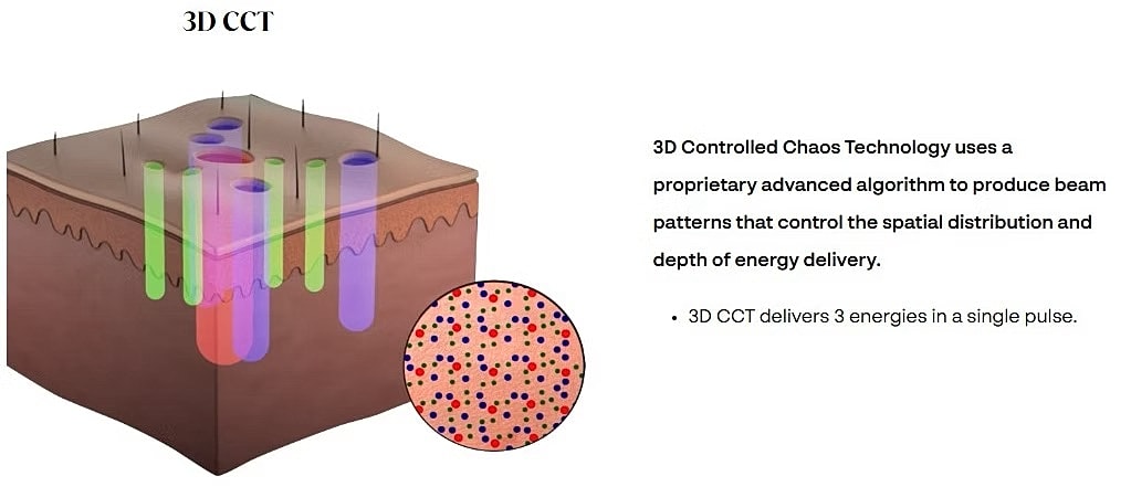 3D Controlled Chaos Technology for energy delivery