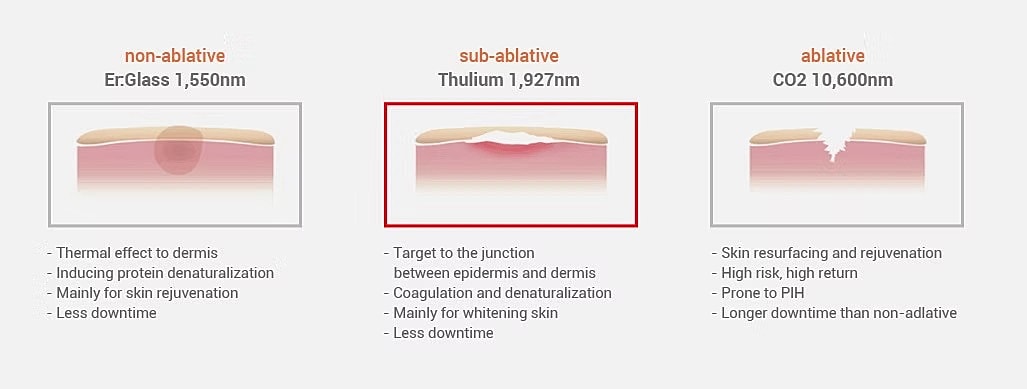 Comparison of laser treatment types and effects