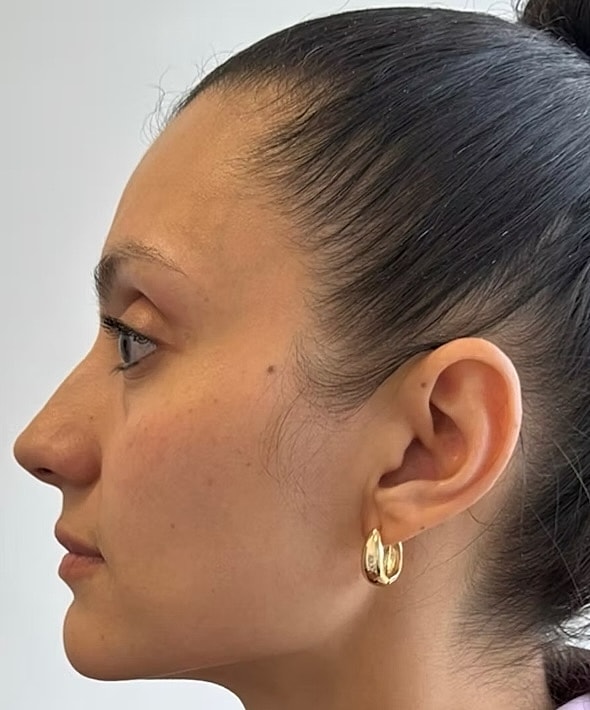 Profile view of a woman with earrings.