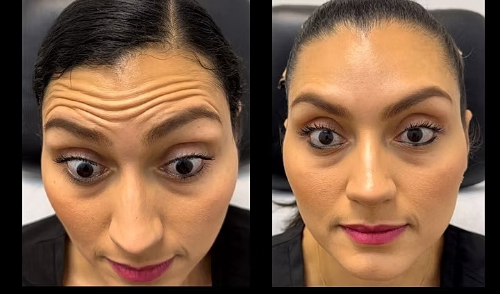Comparison of facial expressions before and after treatment.