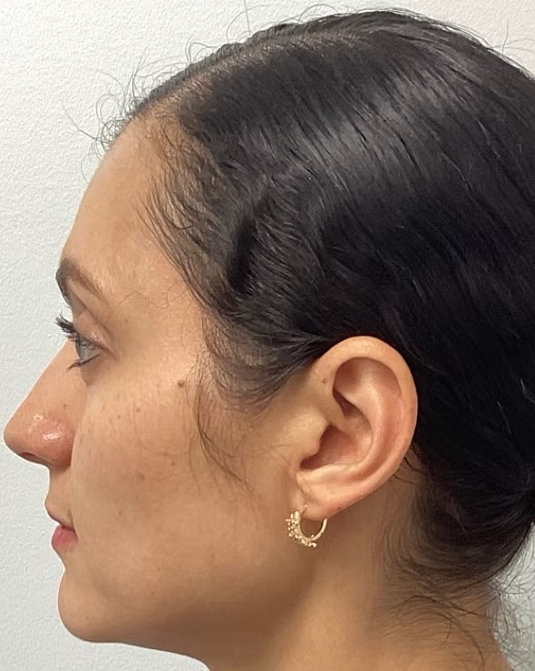Profile view of a woman with earrings.