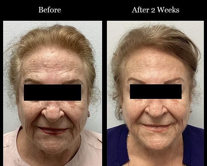 Before and after skin treatment results.