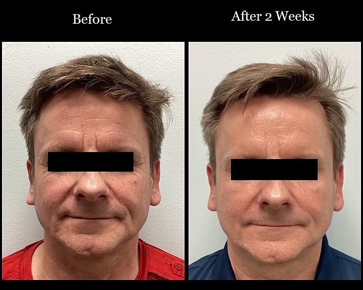 Before and after hair treatment comparison.