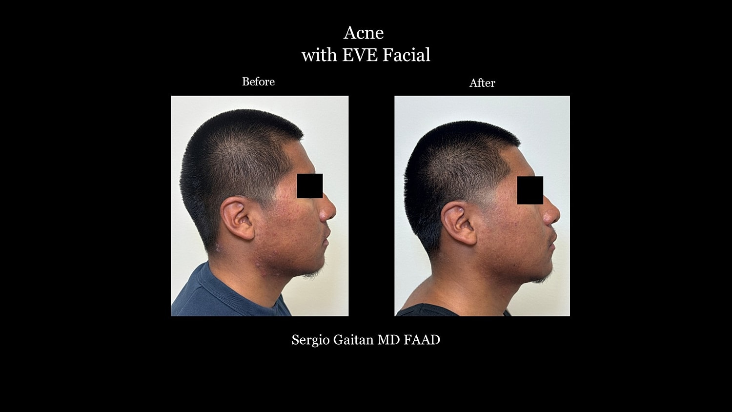 Before & After