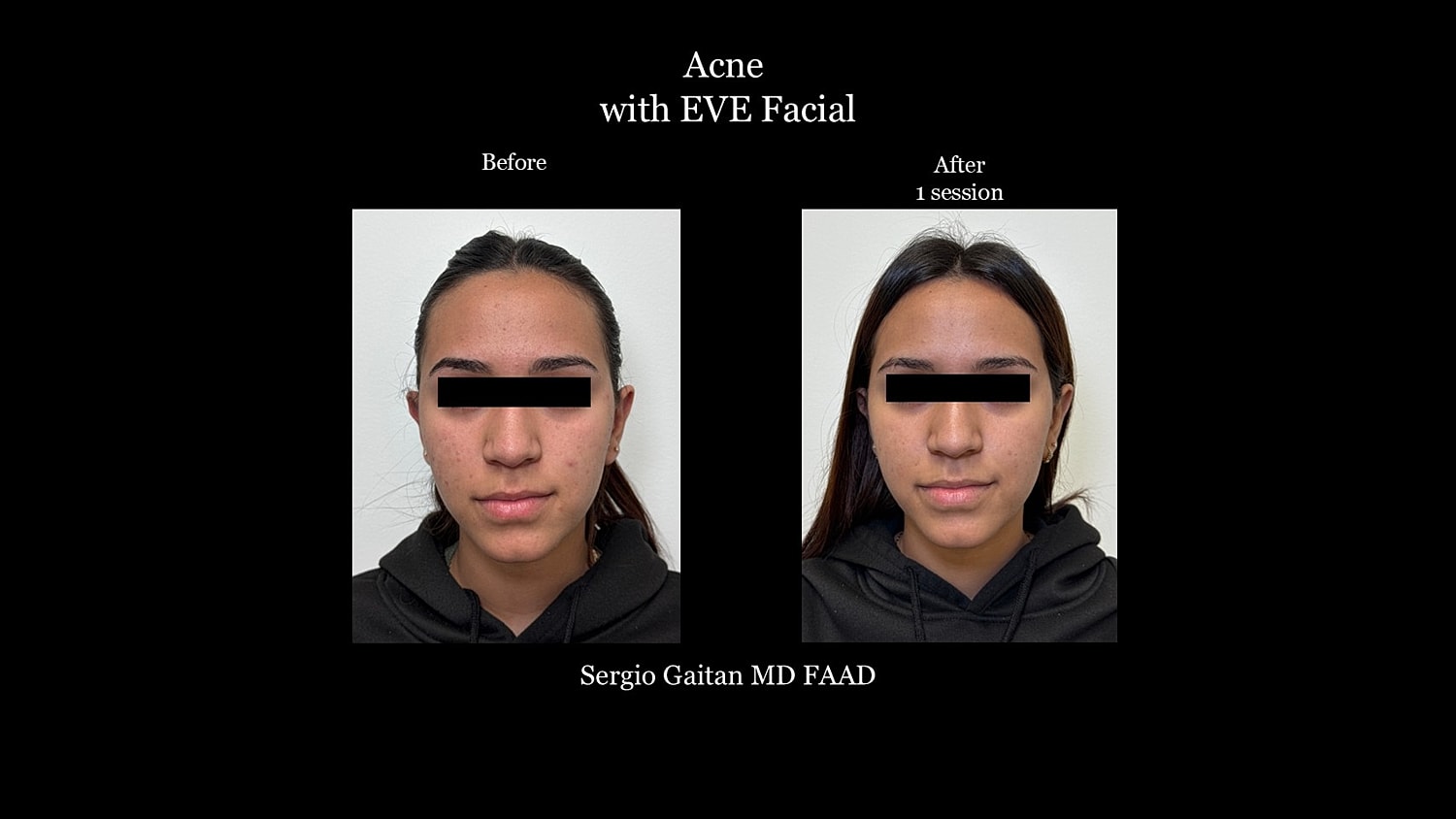 Before & After