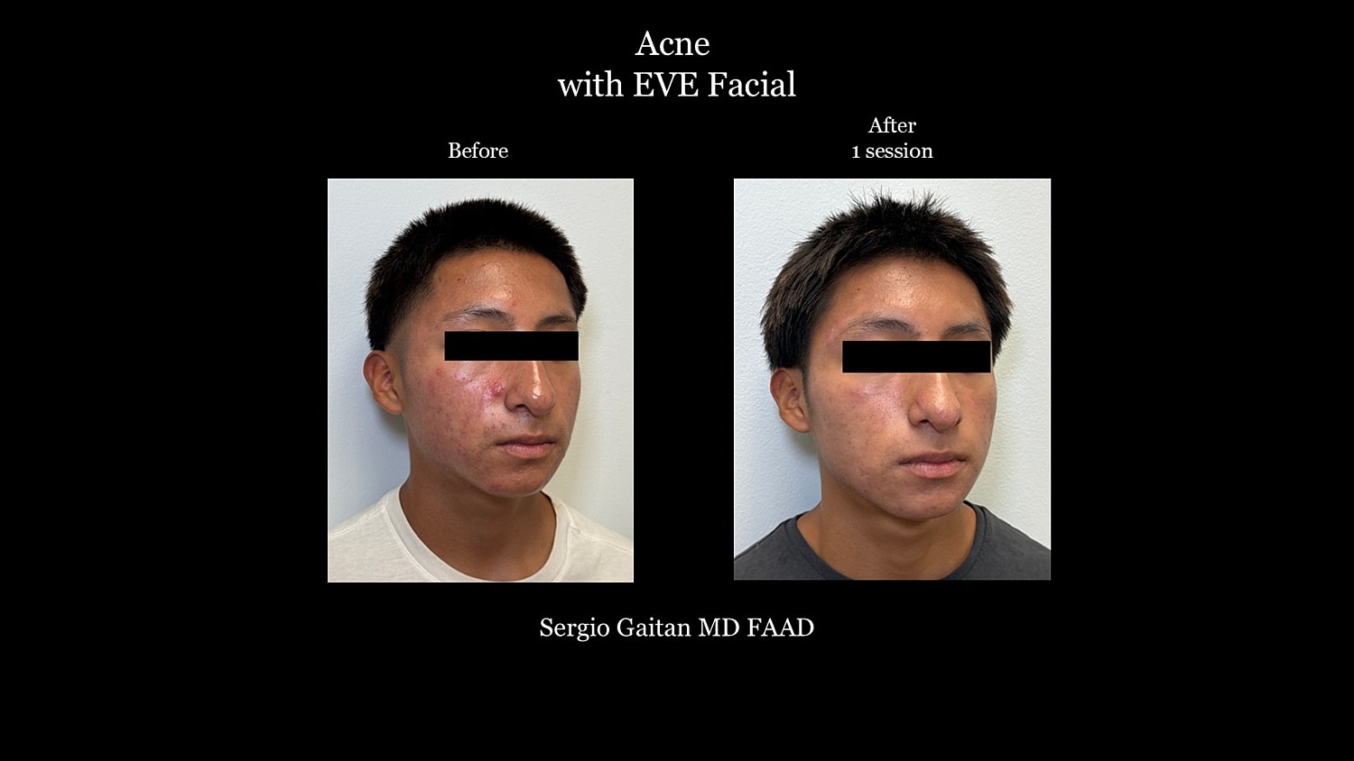 Before & After