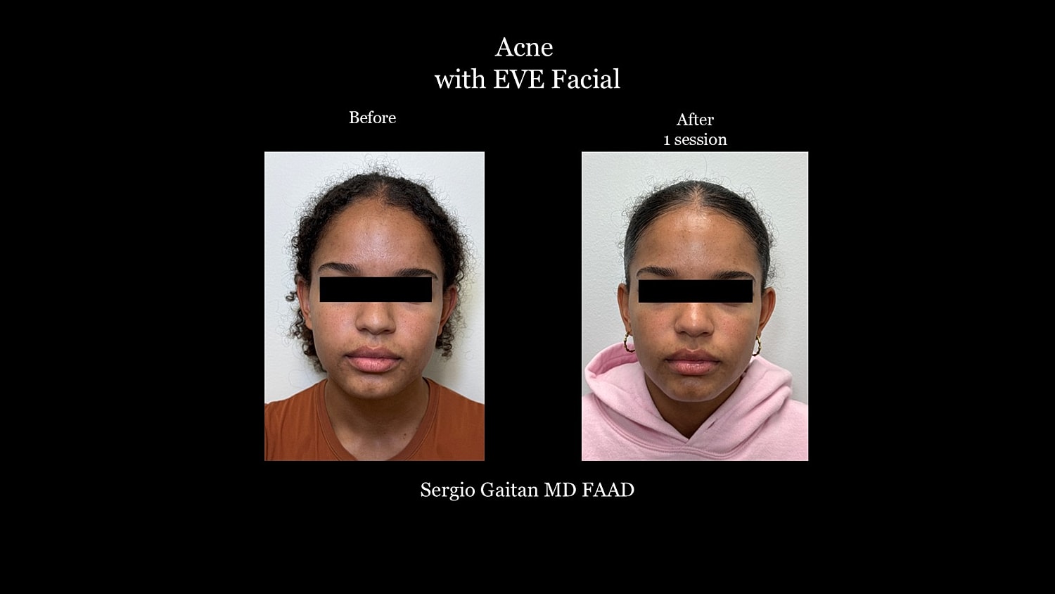Before & After