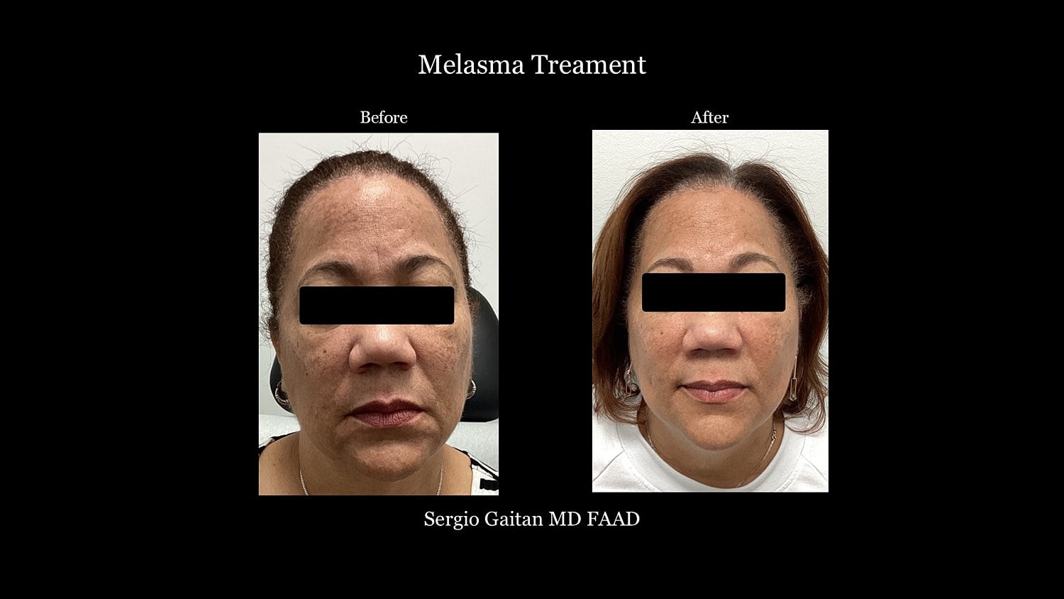 Before & After