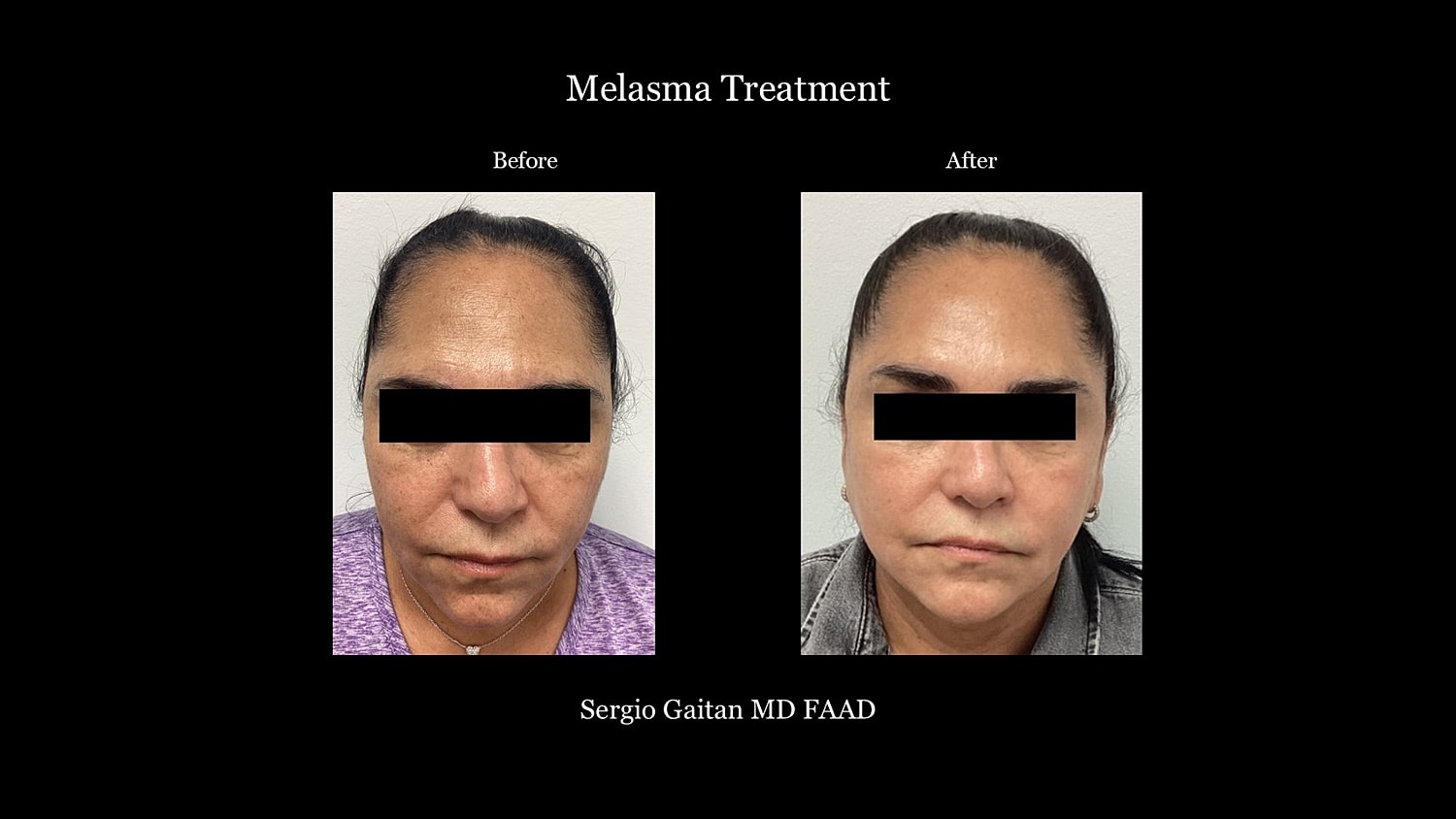 Before & After