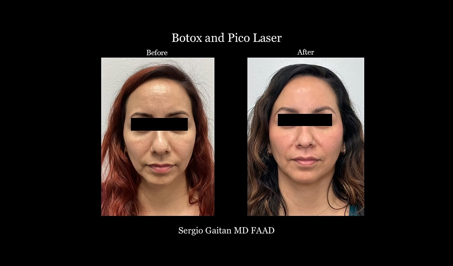 Before & After