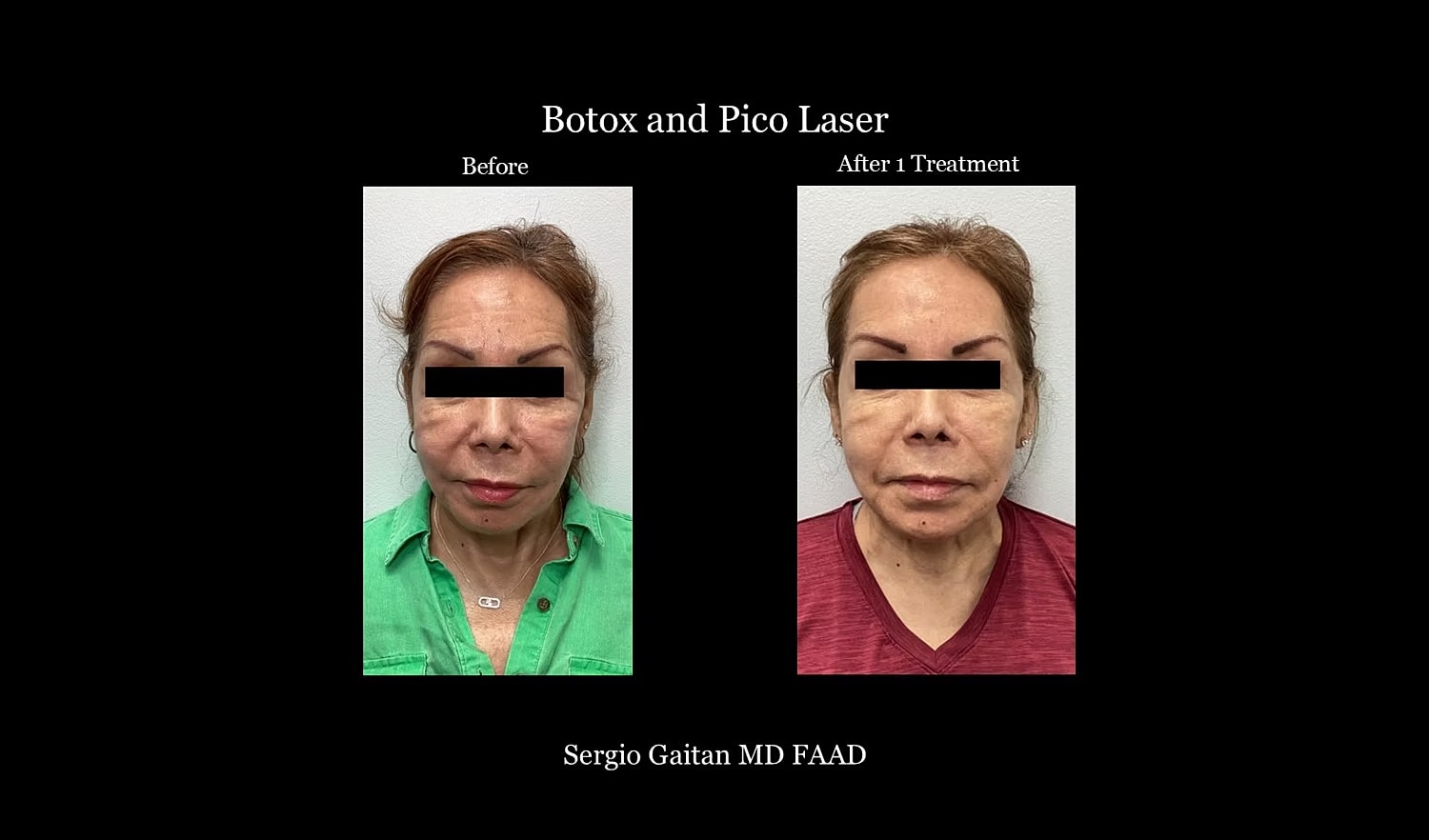 Before & After