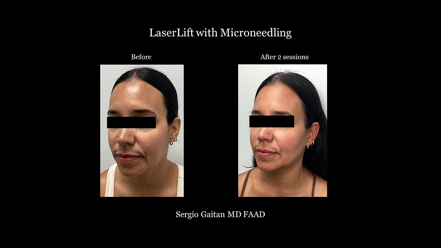 Before & After