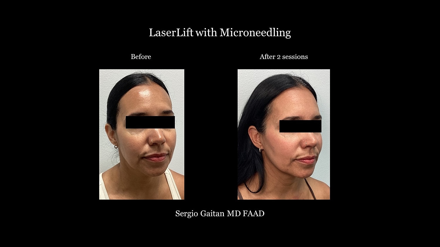 Before & After