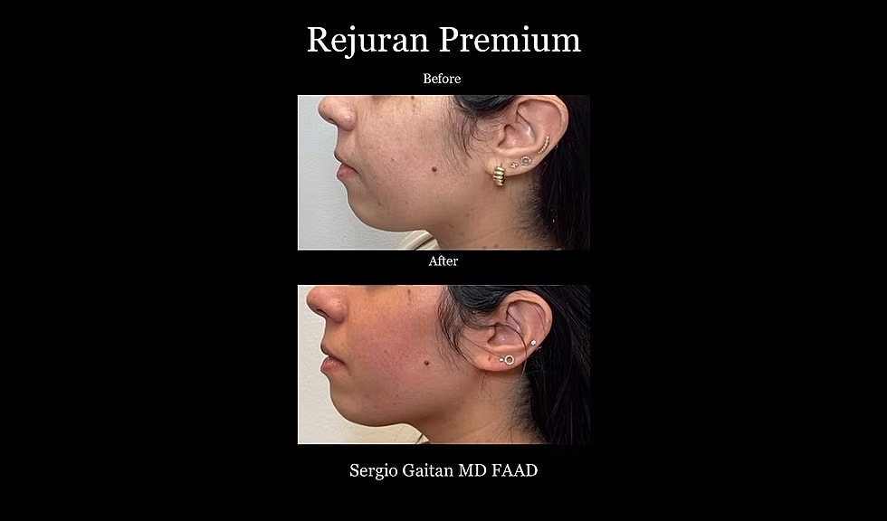 Before & After